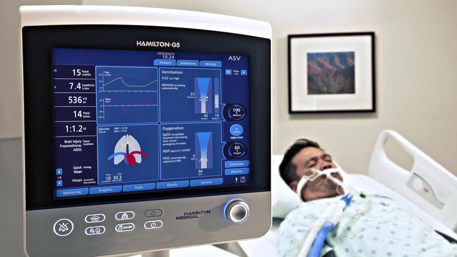 Understanding Ventilators  Saint Luke's Health System