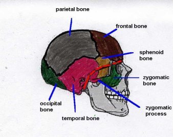 simple skull fracture