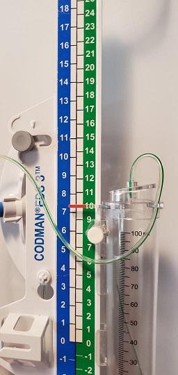 Establishment of an external ventricular drain best practice guideline: the  quest for a comprehensive, universal standard for external ventricular  drain care - Document - Gale Academic OneFile